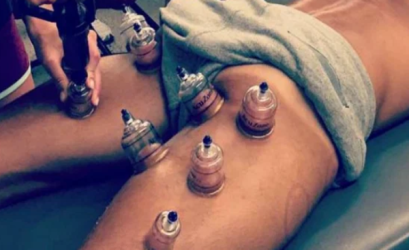 - A köpölyözés, mely a népi gyógyászat és a kínai orvoslás része, mára nemzetközileg elismert módszer. Hatékonyan kezeli a fascia, az izmok, az ízületek, a gerinc és a mozgásszervi fájdalmakat.