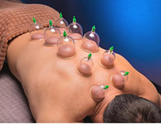 - A köpölyözés, mely a népi gyógyászat és a kínai orvoslás része, mára nemzetközileg elismert módszer. Hatékonyan kezeli a fascia, az izmok, az ízületek, a gerinc és a mozgásszervi fájdalmakat.